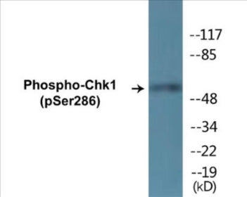Phospho-Chk1 (Ser286) Colorimetric Cell-Based ELISA Kit