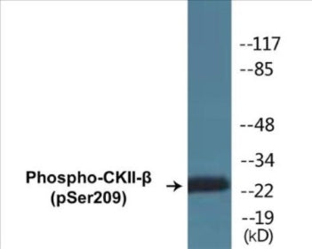 Phospho-CKII-beta (Ser209) Colorimetric Cell-Based ELISA Kit