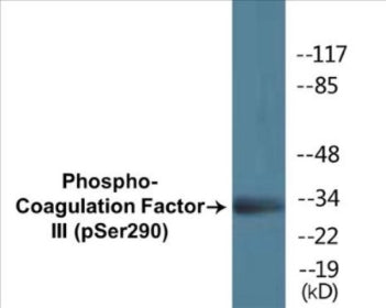 Phospho-Coagulation Factor III (Ser290) Colorimetric Cell-Based ELISA Kit