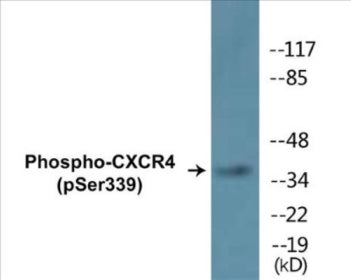 Phospho-CXCR4 (Ser339) Colorimetric Cell-Based ELISA Kit