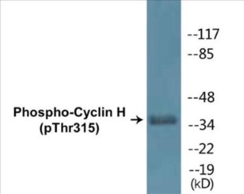 Phospho-Cyclin H (Thr315) Colorimetric Cell-Based ELISA Kit