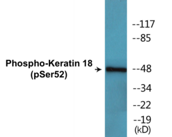 Phospho-Keratin 18 (Ser52) Colorimetric Cell-Based ELISA Kit