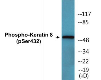 Phospho-Keratin 8 (Ser432) Colorimetric Cell-Based ELISA Kit