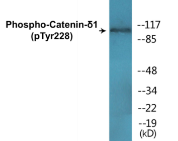 Phospho-Catenin-delta1 (Tyr228) Colorimetric Cell-Based ELISA Kit