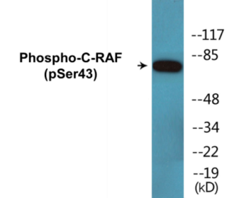 Phospho-C-RAF (Ser43) Colorimetric Cell-Based ELISA Kit