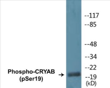 Phospho-CRYAB (Ser19) Colorimetric Cell-Based ELISA Kit