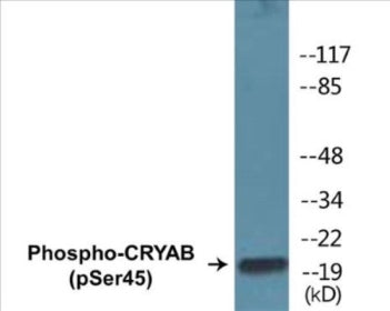 Phospho-CRYAB (Ser45) Colorimetric Cell-Based ELISA Kit