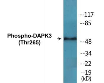 Phospho-DAPK3 (Thr265) Colorimetric Cell-Based ELISA Kit