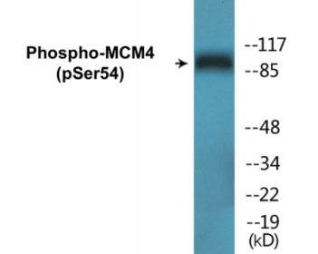 Phospho-MCM4 (Ser54) Colorimetric Cell-Based ELISA Kit