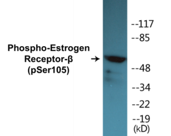 Phospho-Estrogen Receptor-beta (Ser105) Colorimetric Cell-Based ELISA Kit