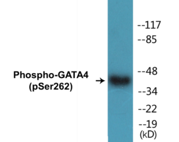 Phospho-GATA4 (Ser262) Colorimetric Cell-Based ELISA Kit