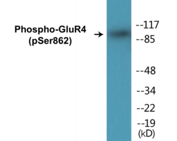 Phospho-GluR4 (Ser862) Colorimetric Cell-Based ELISA Kit