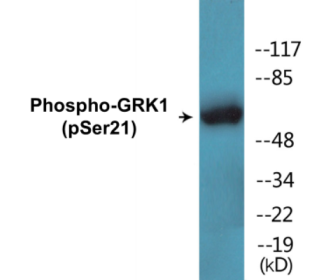 Phospho-GRK1 (Ser21) Colorimetric Cell-Based ELISA Kit
