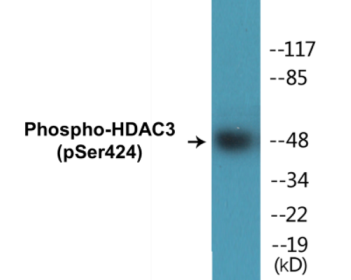 Phospho-HDAC3 (Ser424) Colorimetric Cell-Based ELISA Kit