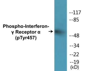 Phospho-Interferon-gamma Receptor alpha (Tyr457) Colorimetric Cell-Based ELISA Kit