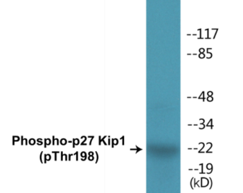 Phospho-p27 Kip1 (Thr198) Colorimetric Cell-Based ELISA Kit