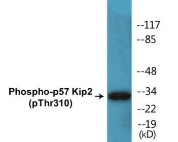 Phospho-p57 Kip2 (Thr310) Colorimetric Cell-Based ELISA Kit
