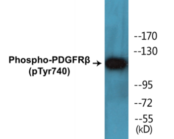 Phospho-PDGFRbeta (Tyr740) Colorimetric Cell-Based ELISA Kit