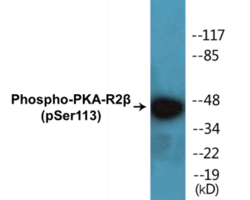 Phospho-PKA-R2beta (Ser113) Colorimetric Cell-Based ELISA Kit