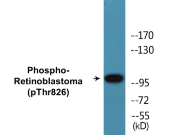 Phospho-Retinoblastoma (Thr826) Colorimetric Cell-Based ELISA Kit