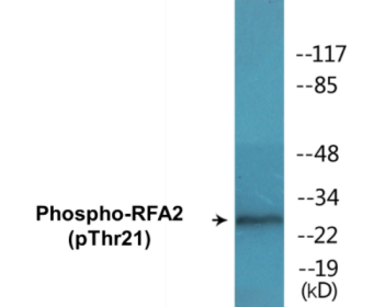 Phospho-RFA2 (Thr21) Colorimetric Cell-Based ELISA Kit
