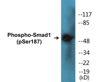 Phospho-Smad1 (Ser187) Colorimetric Cell-Based ELISA Kit