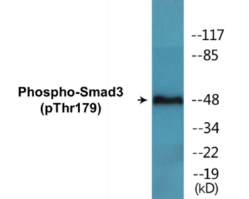 Phospho-Smad3 (Thr179) Colorimetric Cell-Based ELISA Kit