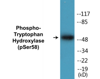 Phospho-Tryptophan Hydroxylase (Ser58) Colorimetric Cell-Based ELISA Kit