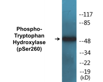 Phospho-Tryptophan Hydroxylase (Ser260) Colorimetric Cell-Based ELISA Kit