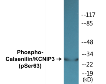 Phospho-Calsenilin/KCNIP3 (Ser63) Colorimetric Cell-Based ELISA Kit