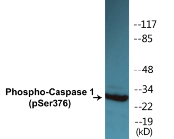 Phospho-Caspase 1 (Ser376) Colorimetric Cell-Based ELISA Kit