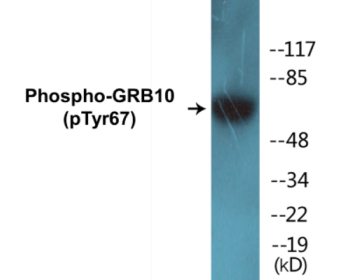 Phospho-GRB10 (Tyr67) Colorimetric Cell-Based ELISA Kit
