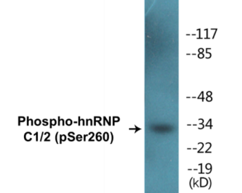 Phospho-hnRNP C1/2 (Ser260) Colorimetric Cell-Based ELISA Kit