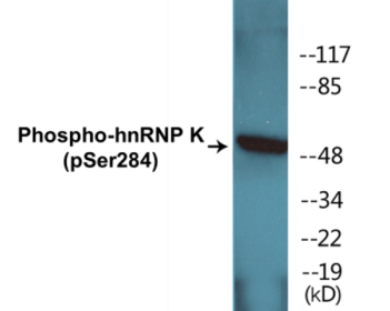 Phospho-hnRNP K (Ser284) Colorimetric Cell-Based ELISA Kit