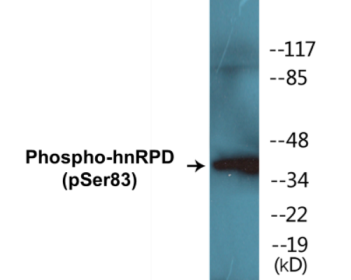 Phospho-hnRPD (Ser83) Colorimetric Cell-Based ELISA Kit