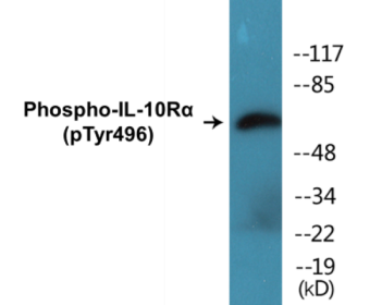 Phospho-IL-10Ralpha (Tyr496) Colorimetric Cell-Based ELISA Kit