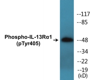 Phospho-IL-13Ralpha1 (Tyr405) Colorimetric Cell-Based ELISA Kit