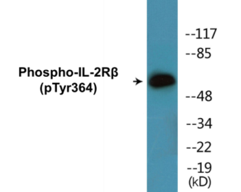 Phospho-IL-2Rbeta (Tyr364) Colorimetric Cell-Based ELISA Kit