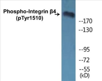 Phospho-Integrin beta4 (Tyr1510) Colorimetric Cell-Based ELISA Kit