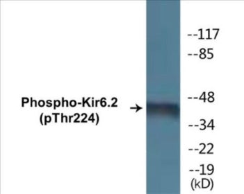 Phospho-Kir6.2 (Thr224) Colorimetric Cell-Based ELISA Kit