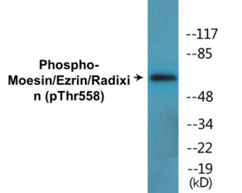 Phospho-Moesin/Ezrin/Radixin (Thr558) Colorimetric Cell-Based ELISA Kit