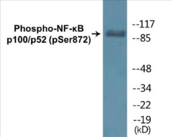 Phospho-NF-κB p100/p52 (Ser872) Colorimetric Cell-Based ELISA Kit