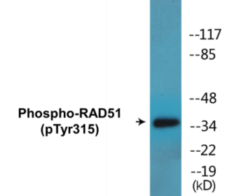 Phospho-RAD51 (Tyr315) Colorimetric Cell-Based ELISA Kit