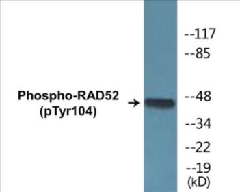 Phospho-RAD52 (Tyr104) Colorimetric Cell-Based ELISA Kit