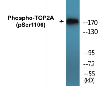 Phospho-TOP2A (Ser1106) Colorimetric Cell-Based ELISA Kit