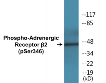 Phospho-Adrenergic Receptor beta2 (Ser346) Colorimetric Cell-Based ELISA Kit