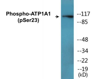 Phospho-ATP1A1 (Ser23) Colorimetric Cell-Based ELISA Kit