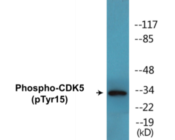 Phospho-CDK5 (Tyr15) Colorimetric Cell-Based ELISA Kit
