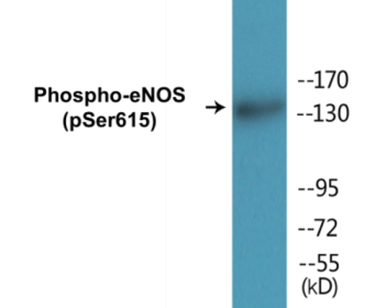 Phospho-eNOS (Ser615) Colorimetric Cell-Based ELISA Kit