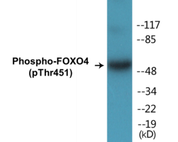 Phospho-FOXO4 (Thr451) Colorimetric Cell-Based ELISA Kit